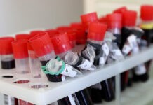В Японии создали универсальную искусственную кровь, которую можно переливать всем В Японии создали универсальную искусственную кровь, которую можно переливать всем