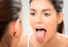 Будь внимательным к сигналам тела: о каких заболеваниях можно узнать по цвету языка