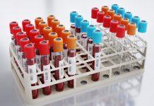 Лейкоз можно лечить без осложнений? Ученые раскрыли неожиданный механизм Лейкоз можно лечить без осложнений? Ученые раскрыли неожиданный механизм