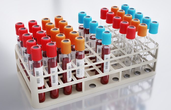 Лейкоз можно лечить без осложнений? Ученые раскрыли неожиданный механизм Лейкоз можно лечить без осложнений? Ученые раскрыли неожиданный механизм