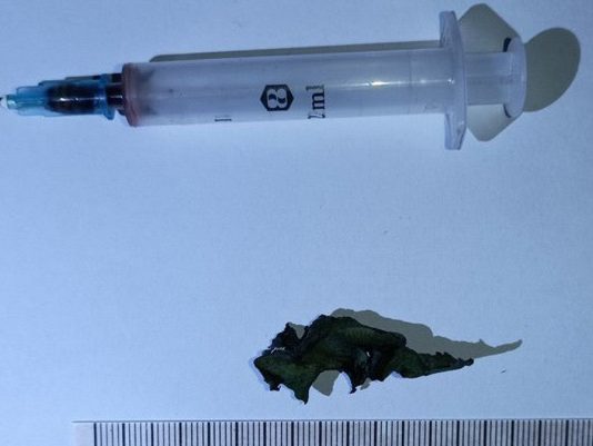 18‑летняя девушка умерла от передозировки: в организме нашли восемь видов наркотиков Кричев | Новости Кричева и Кричевского района